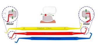 prepsure by contacez